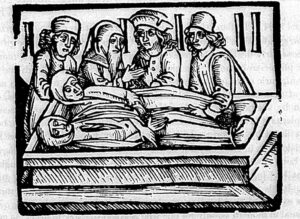 What Was The Mysterious Sweating Sickness | Legends From History